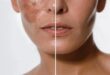 Manchas na pele? Creme coreano de vitamina C ajuda a suavizar marcas